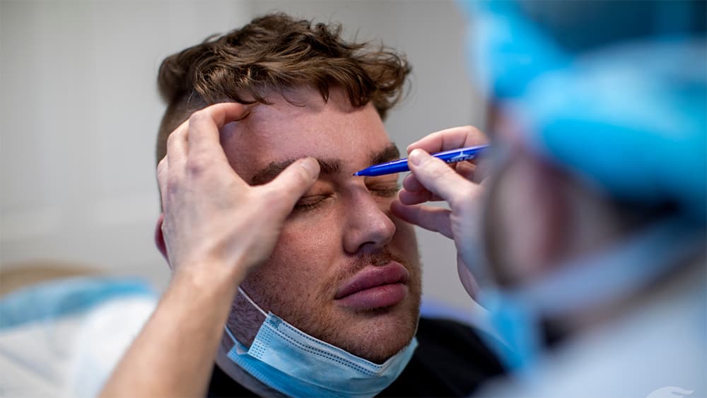 Man preparing for eyelid surgery