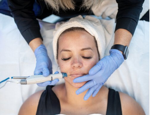 Woman receiving skin rejuvenation treatment at medspa